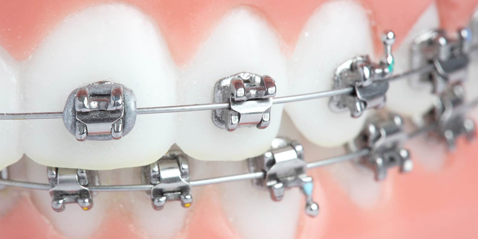歯科矯正専門医師による「先進的な技術を用いた矯正治療」